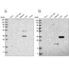 Western blot analysis using Anti-RGN antibody HPA029102 (A) shows similar pattern to independent antibody HPA029103 (B).