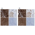 Immunohistochemical staining of human adrenal gland, kidney, liver and tonsil using Anti-RGN antibody HPA029103 (A) shows similar protein distribution across tissues to independent antibody HPA029102 (B).