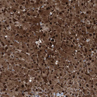 Immunohistochemical staining of human liver shows strong positivity in hepatocytes.