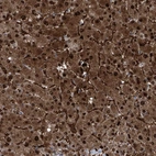 Immunohistochemical staining of human liver shows strong positivity in hepatocytes.