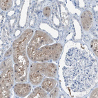 Immunohistochemical staining of human kidney shows moderate cytoplasmic positivity in cells in tubules.