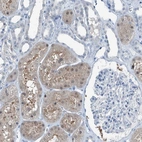 Immunohistochemical staining of human kidney shows moderate cytoplasmic positivity in cells in tubules.