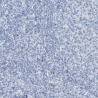 Immunohistochemical staining of human tonsil shows no positivity in non-germinal center cells as expected.
