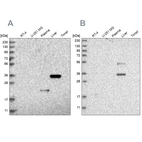 Western blot analysis using Anti-RGN antibody HPA029103 (A) shows similar pattern to independent antibody HPA029102 (B).