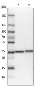Lane 1: Mouse liver tissue lysate_br/_Lane 2: Rat liver tissue lysate