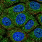 Anti-TMEM254 Antibody