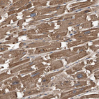 Anti-KCNJ2 Antibody