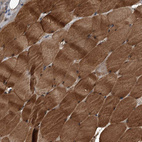 Immunohistochemical staining of human skeletal muscle shows strong cytoplasmic positivity in myocytes.