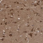 Immunohistochemical staining of human cerebral cortex shows strong cytoplasmic positivity in neurons.