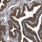 Immunohistochemical staining of human fallopian tube shows moderate cytoplasmic positivity in glandular cells.