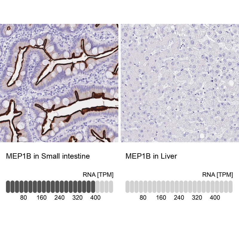 Anti-MEP1B Antibody