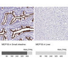 Anti-MEP1B Antibody