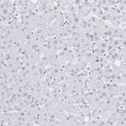 Immunohistochemical staining of human liver shows no positivity in hepatocytes as expected.