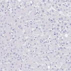 Immunohistochemical staining of human liver shows no positivity in hepatocytes as expected.