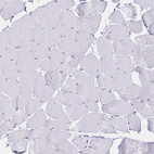 Immunohistochemical staining of human skeletal muscle shows no positivity in myocytes as expected.