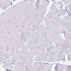 Immunohistochemical staining of human skeletal muscle shows no positivity in myocytes as expected.