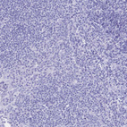 Immunohistochemical staining of human tonsil shows no positivity in non-germinal center cells as expected.