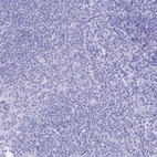 Immunohistochemical staining of human tonsil shows no positivity in non-germinal center cells as expected.