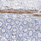 Immunohistochemical staining of human small intestine shows strong cytoplasmic positivity in smooth muscle cells.