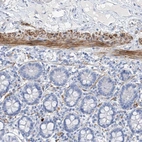Immunohistochemical staining of human small intestine shows strong cytoplasmic positivity in smooth muscle cells.