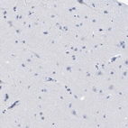 Immunohistochemical staining of human cerebral cortex shows no positivity in neurons as expected.