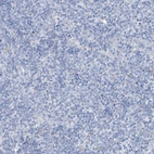 Immunohistochemical staining of human tonsil shows no positivity in non-germinal center cells as expected.