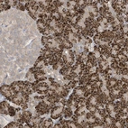 Anti-LRRN2 Antibody