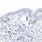 Immunohistochemical staining of human skin shows moderate granular cytoplasmic positivity in basal epidermal cells.