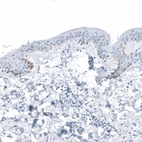 Immunohistochemical staining of human skin shows moderate granular cytoplasmic positivity in basal epidermal cells.