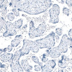Anti-HSD17B13 Antibody