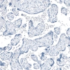 Immunohistochemical staining of human placenta shows no positivity in trophoblastic cells as expected.