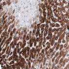 Immunohistochemical staining of human liver shows moderate to strong granular cytoplasmic positivity in hepatocytes.