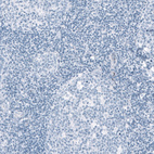 Anti-HSD17B13 Antibody
