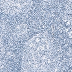 Immunohistochemical staining of human tonsil shows no positivity in lymphoid cells as expected.