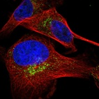 Immunofluorescent staining of human cell line U-251 MG shows localization to the Golgi apparatus & vesicles.