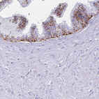 Immunohistochemical staining of human prostate shows moderate positivity in lysosomes in glandular cells.