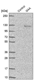 Western blot analysis in control (vector only transfected HEK293T lysate) and GAA over-expression lysate (Co-expressed with a C-terminal myc-DDK tag (~3.1 kDa) in mammalian HEK293T cells, LY400052).