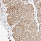 Anti-WFS1 Antibody