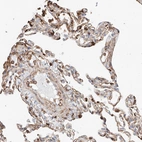 Immunohistochemical staining of human Lung shows strong granular cytoplasmic positivity in pneumocytes.
