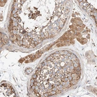 Immunohistochemical staining of human Testis shows strong granular cytoplasmic positivity in cells in seminiferous ducts and leydig cells.