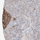 Immunohistochemical staining of human Pancreas shows strong granular cytoplasmic positivity in islets of Langerhans.