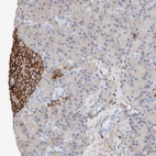 Immunohistochemical staining of human Pancreas shows strong granular cytoplasmic positivity in islets of Langerhans.