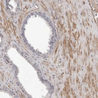 Immunohistochemical staining of human prostate shows moderate cytoplasmic positivity in smooth muscle cells.