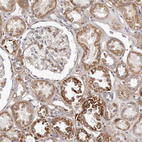 Immunohistochemical staining of human kidney shows moderate granular cytoplasmic positivity in cells in tubules.