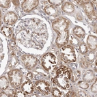 Immunohistochemical staining of human kidney shows moderate granular cytoplasmic positivity in cells in tubules.