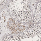 Immunohistochemical staining of human testis shows weak granular cytoplasmic positivity in Leydig cells.