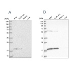 Western blot analysis using Anti-MRPS10 antibody HPA029133 (A) shows similar pattern to independent antibody HPA029134 (B).