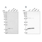 Western blot analysis using Anti-MRPS10 antibody HPA029133 (A) shows similar pattern to independent antibody HPA029134 (B).