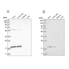 Anti-MRPS10 Antibody