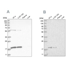 Western blot analysis using Anti-MRPS10 antibody HPA029134 (A) shows similar pattern to independent antibody HPA029133 (B).